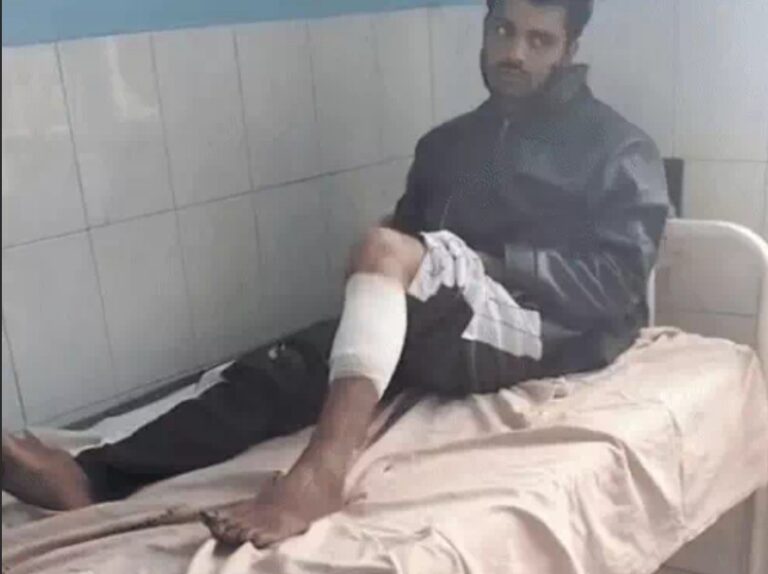 पुलिस को देखते ही भागा बदमाश, फायरिंग के बाद घायल हालत में पकड़ा गया