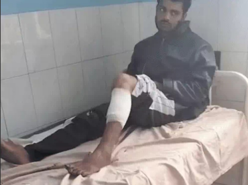 पुलिस को देखते ही भागा बदमाश, फायरिंग के बाद घायल हालत में पकड़ा गया